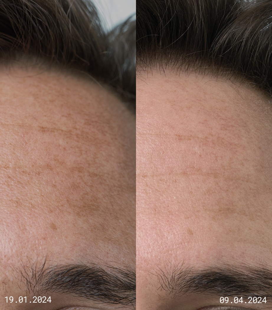 EMMA LEWISHAM Skin Reset Serum Refill (30ml) Image 4