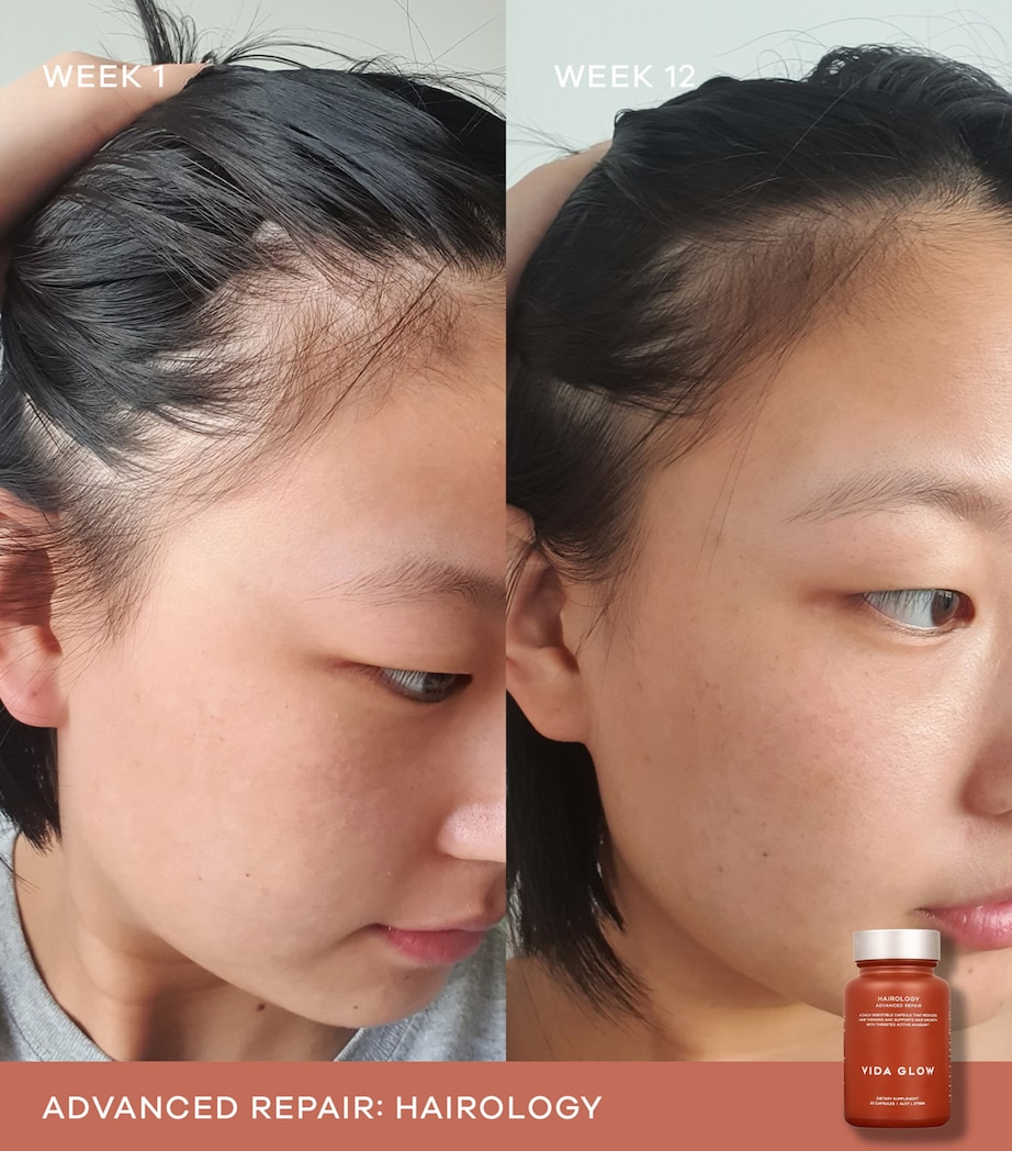 Hairology (30 Capsules) NO COLOUR Image 7